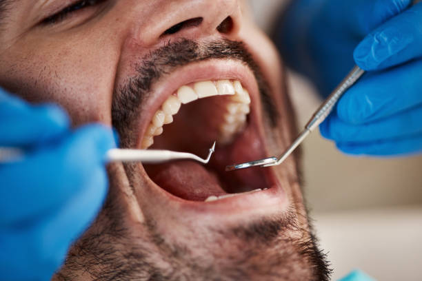 Best Emergency Dentist for Special Needs Patients in Lake Darby, OH