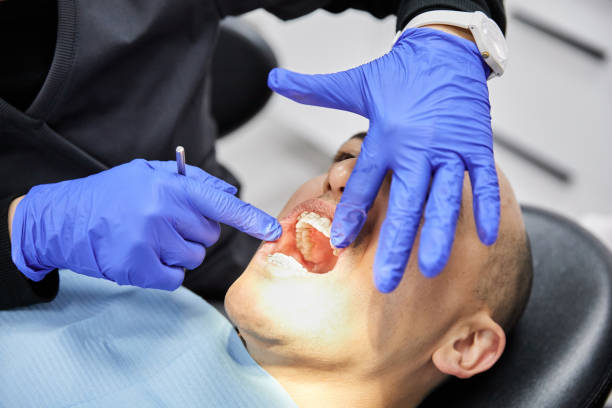 Best Emergency Dentist for Knocked-Out Tooth in Lake Darby, OH